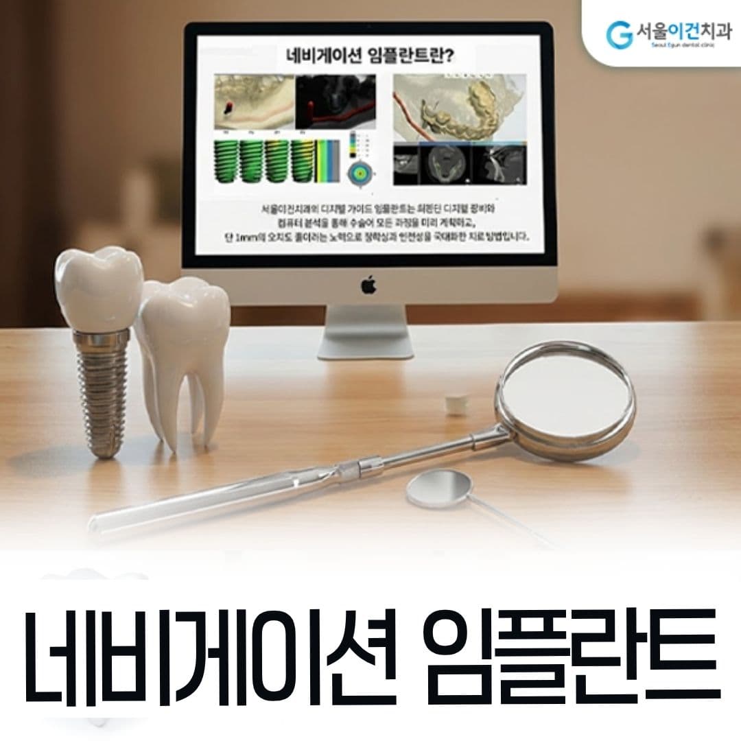 네비게이션 임플란트 디지털 진단 안내 이미지